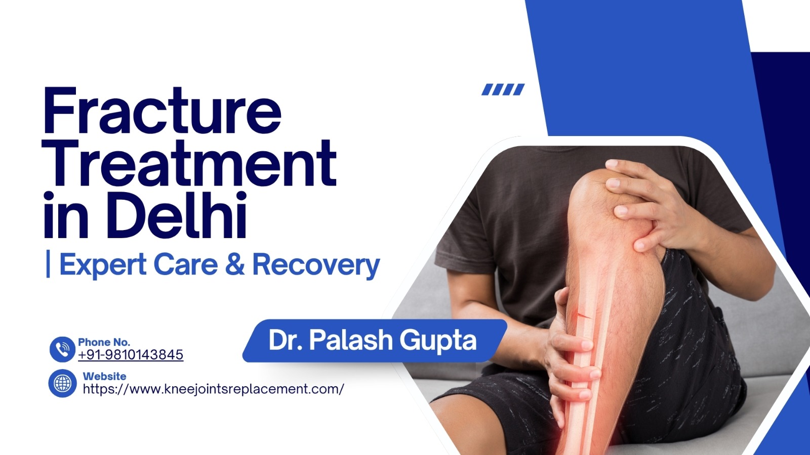 Fracture Treatment in Delhi



